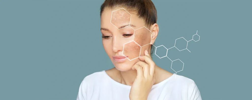 Hyperpigmentation Skincare: Best Ingredients to Brighten and Even Skin Tone