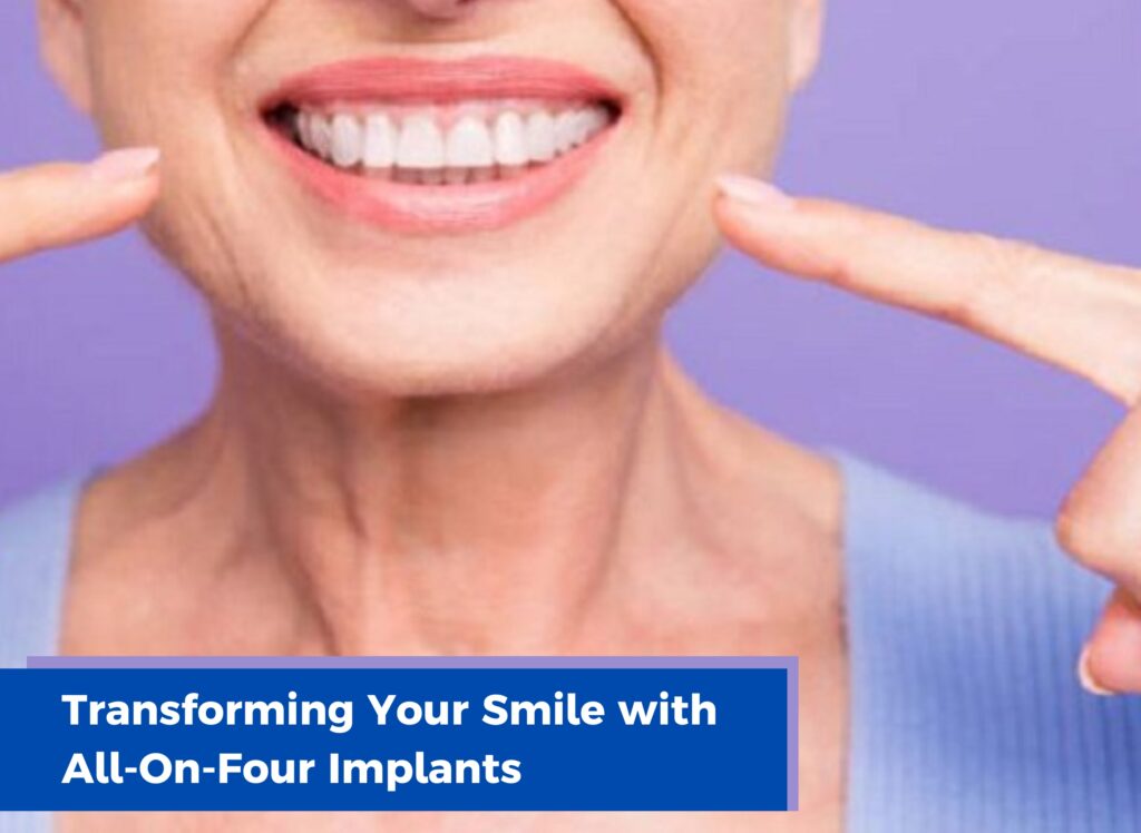 A New Beginning for Your Smile: Discover the Power of All-on-4 Dental Implants
